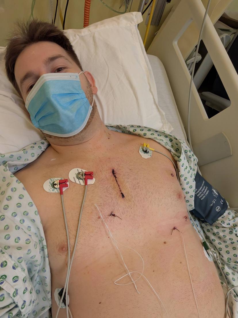 Patrik showing surgical scar after first heart surgery